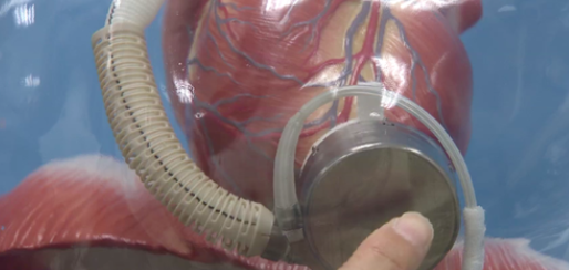 全磁懸浮人工心臟